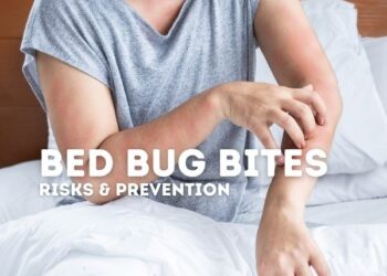 itching skin from bed bug bites