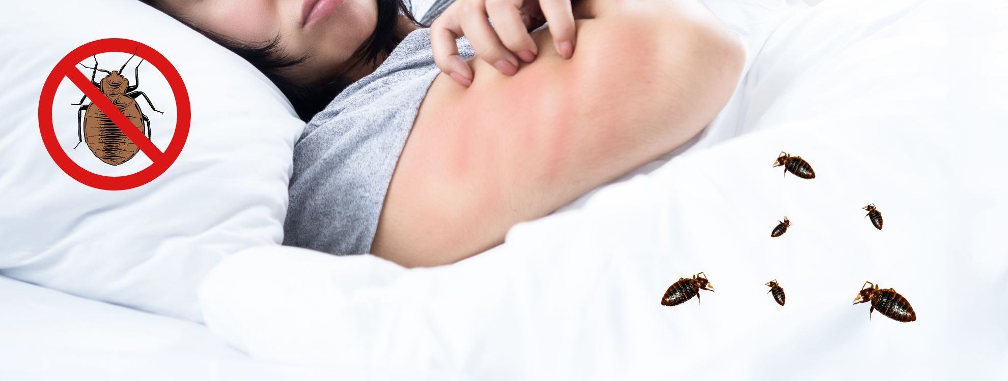 bed bug bites and itchy skin