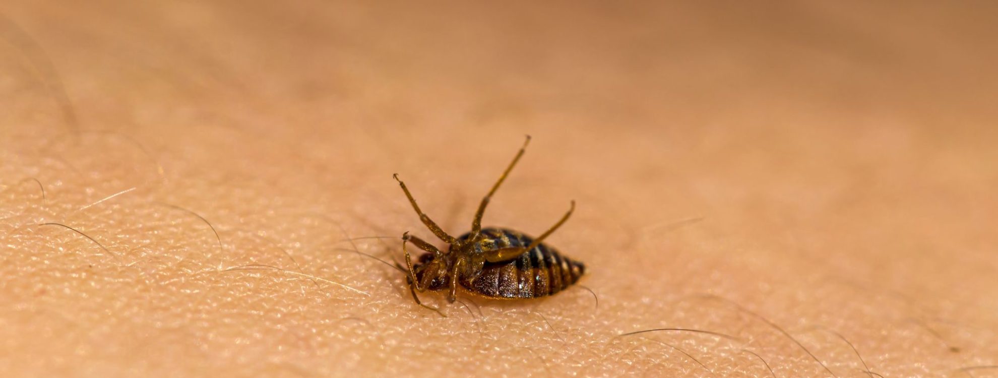 bedbug on human skin